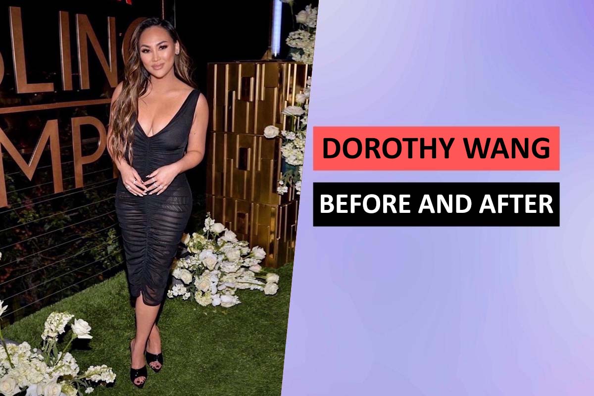 Dorothy Wang Before and After