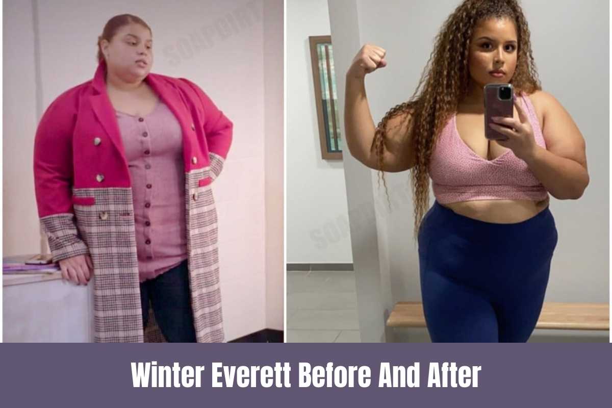 Winter Everett Before And After