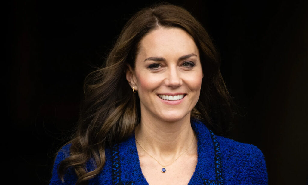 Kate Middleton Plastic Surgery