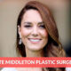 Kate Middleton Plastic Surgery