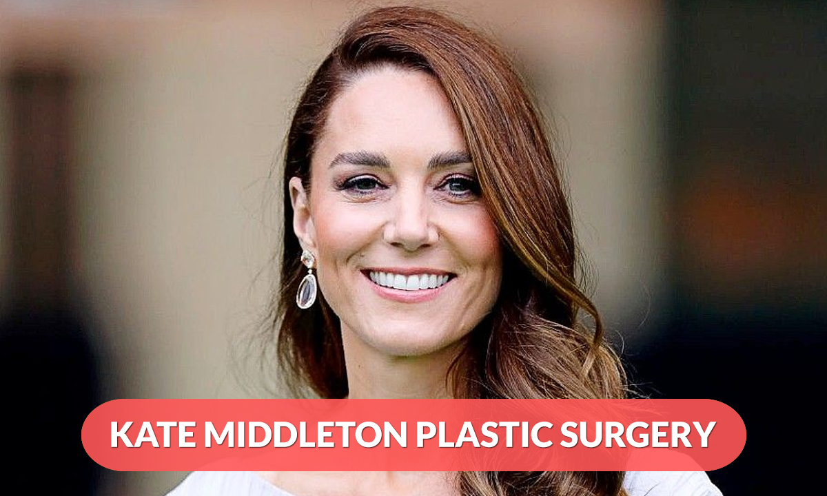 Kate Middleton Plastic Surgery