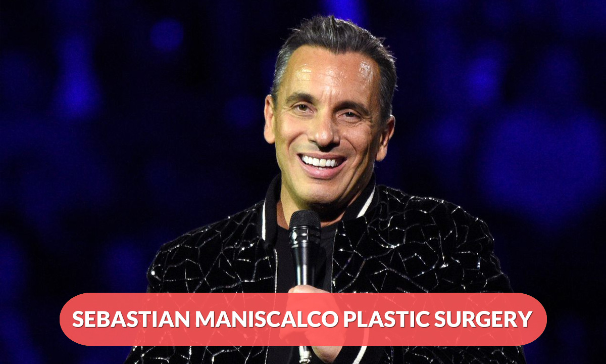 Sebastian Maniscalco Plastic Surgery