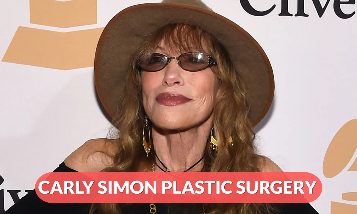 Carly Simon Plastic Surgery