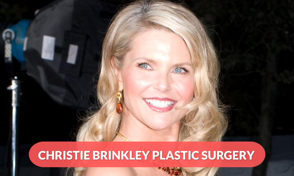 Christie Brinkley Plastic Surgery