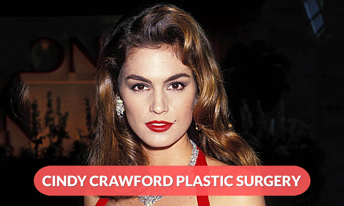 Cindy Crawford Plastic Surgery
