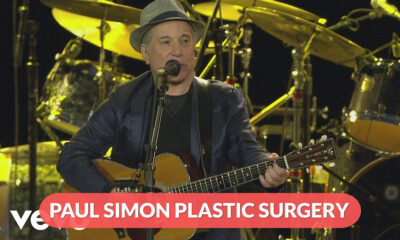 Paul Simon Plastic Surgery