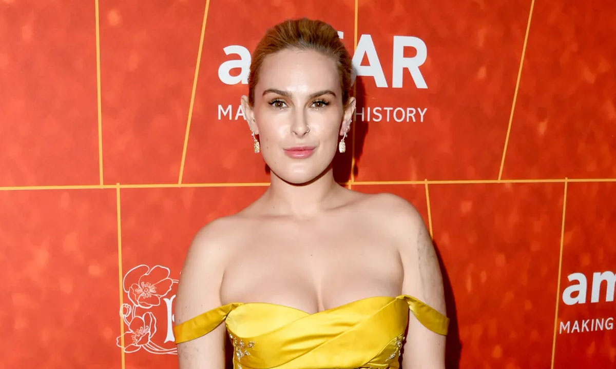 Rumer Willis Plastic Surgery Are The Rumors Of Her Plastic Surgery True Regaltribune