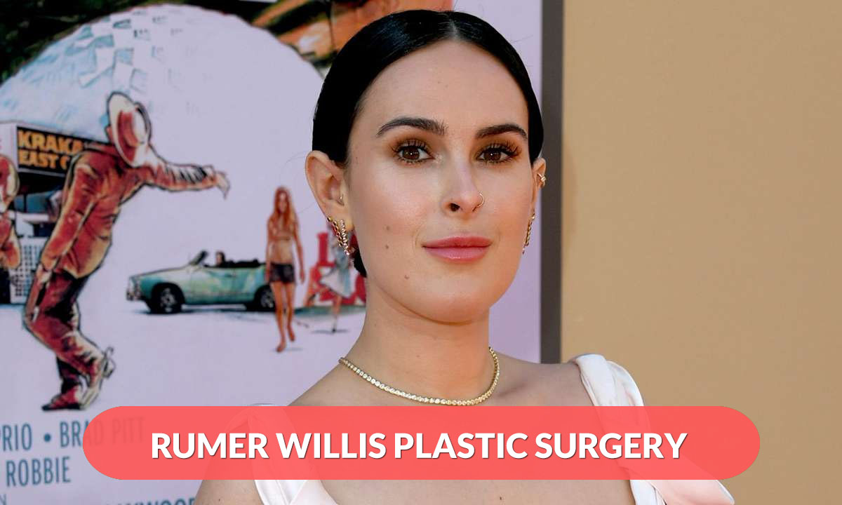 Rumer Willis Plastic Surgery