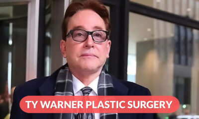 Ty Warner Plastic Surgery